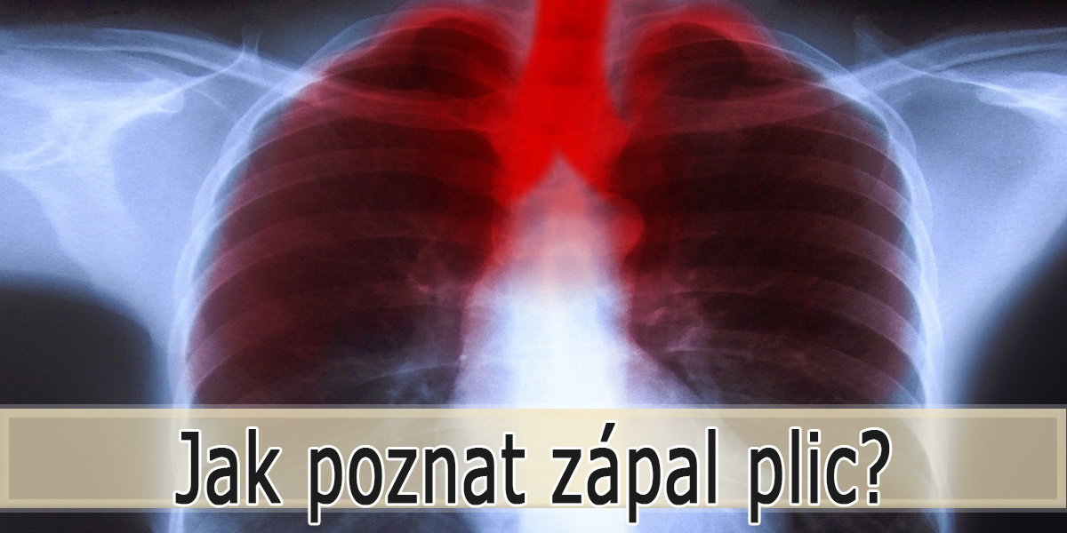 Jak se pozná zápal plic